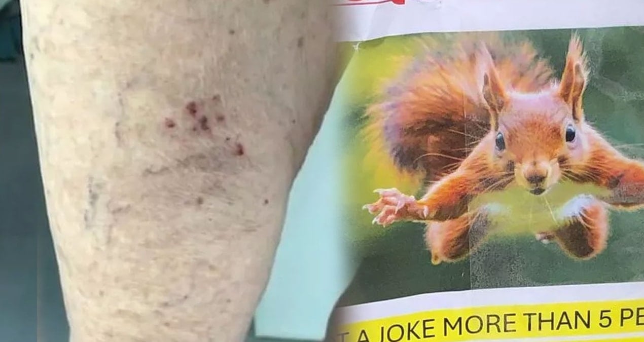 bir anda mahalleye dadandi kimse guvende degil herkes tedirgin HwNzXwZw