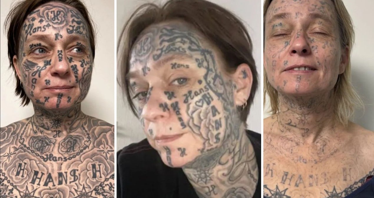 Eski Sevgilisi Tarafından 250 Dövme Zorunluluğu: Kadının Şok Hikayesi